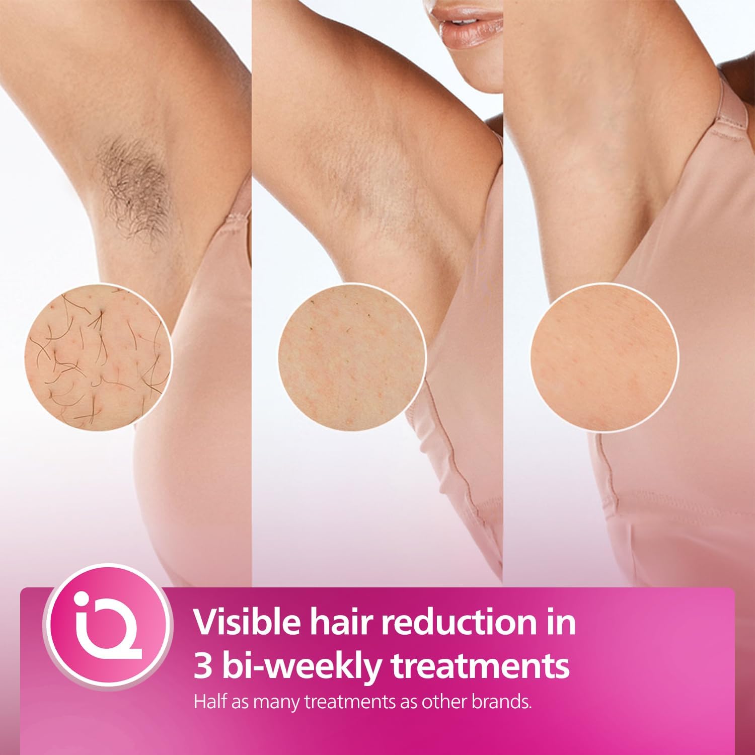 جهاز Philips Lumea 8000 لإزالة الشعر بتقنية IPL! - الصورة 7