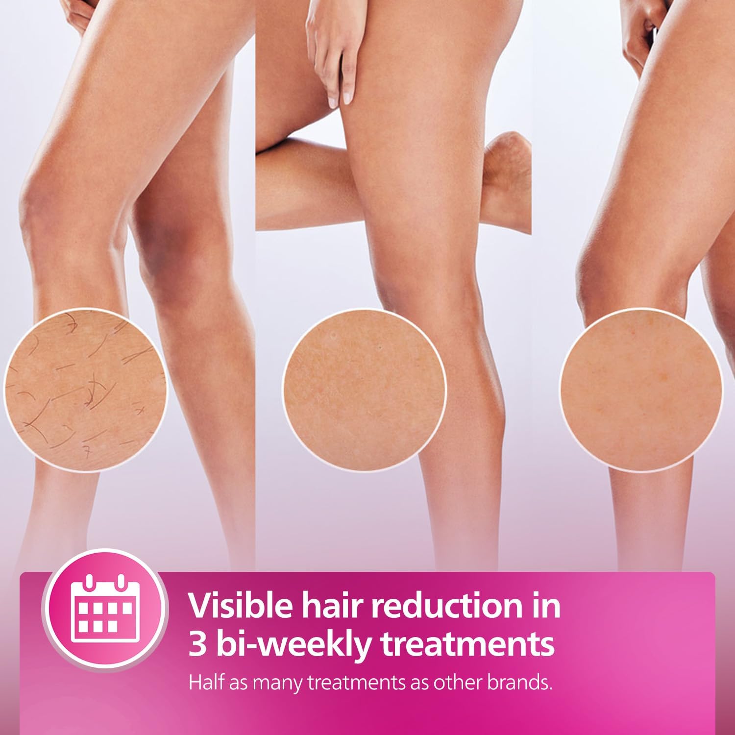 جهاز Philips Lumea 8000 لإزالة الشعر بتقنية IPL! - الصورة 11